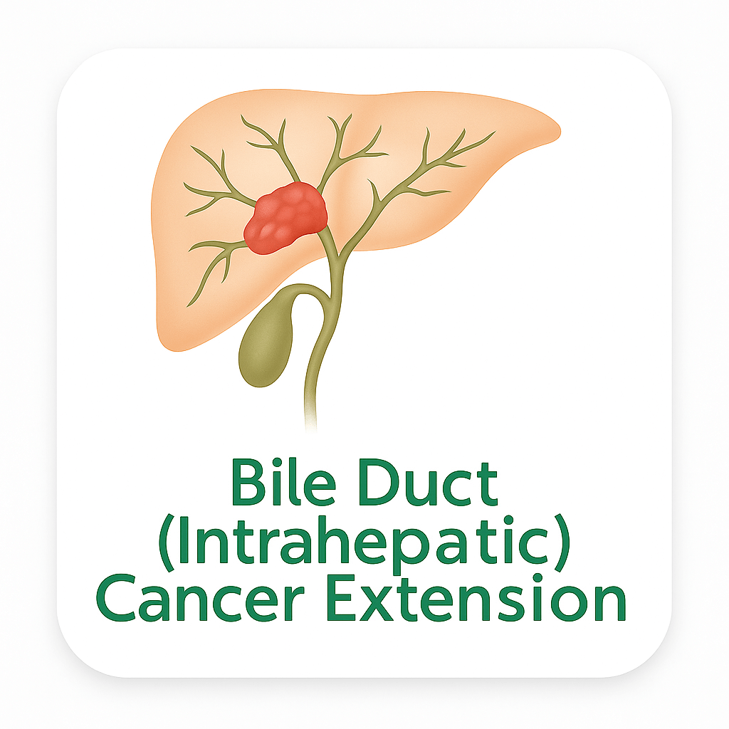 Bile Duct (Intrahepatic) Cancer Extension