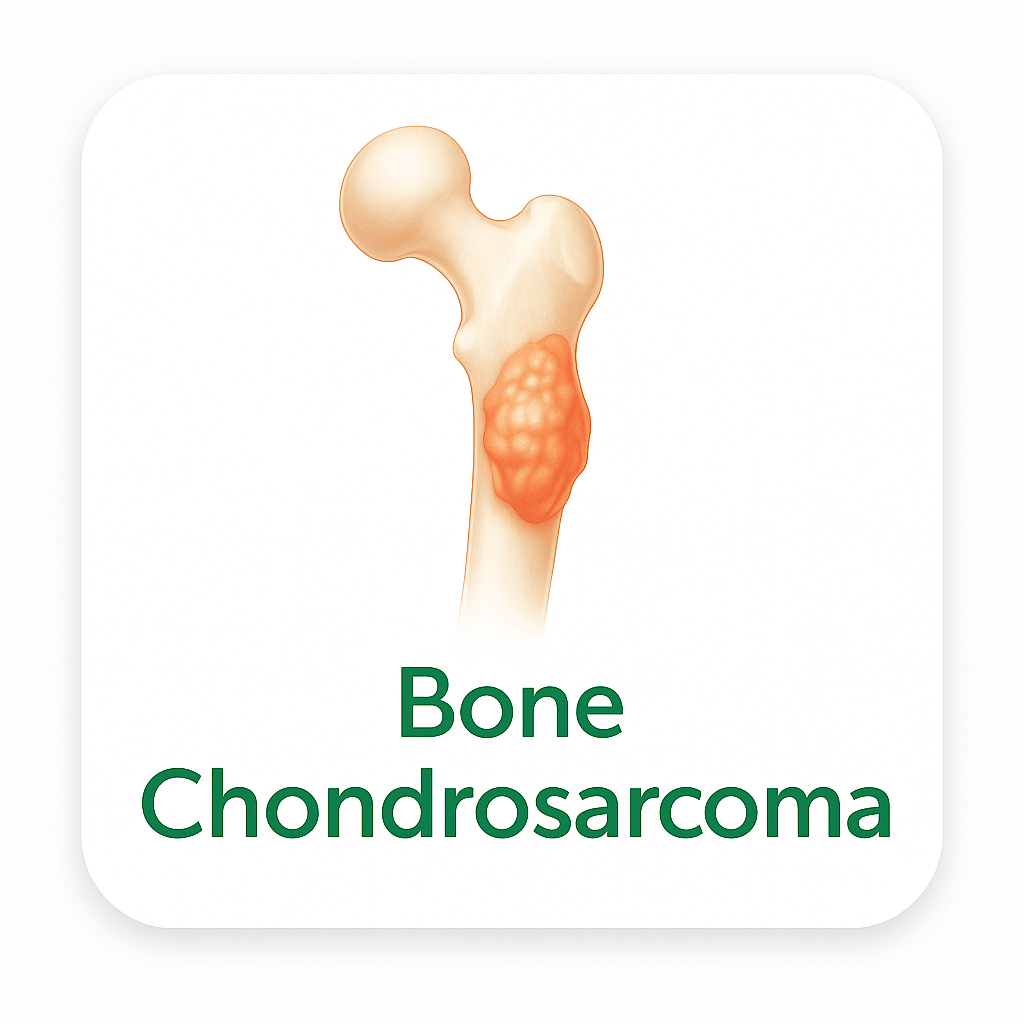 Bone Chondrosarcoma