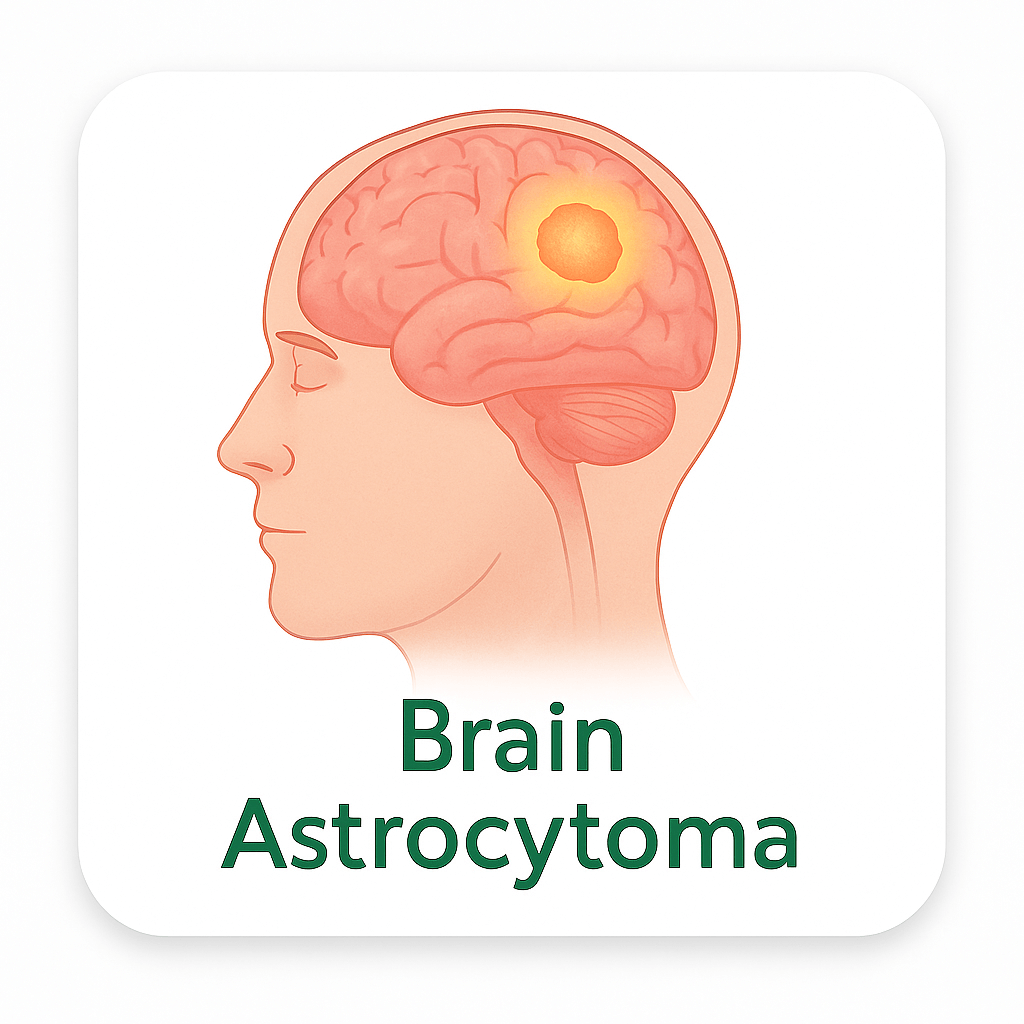 Brain Astrocytoma – Adult Low-Grade