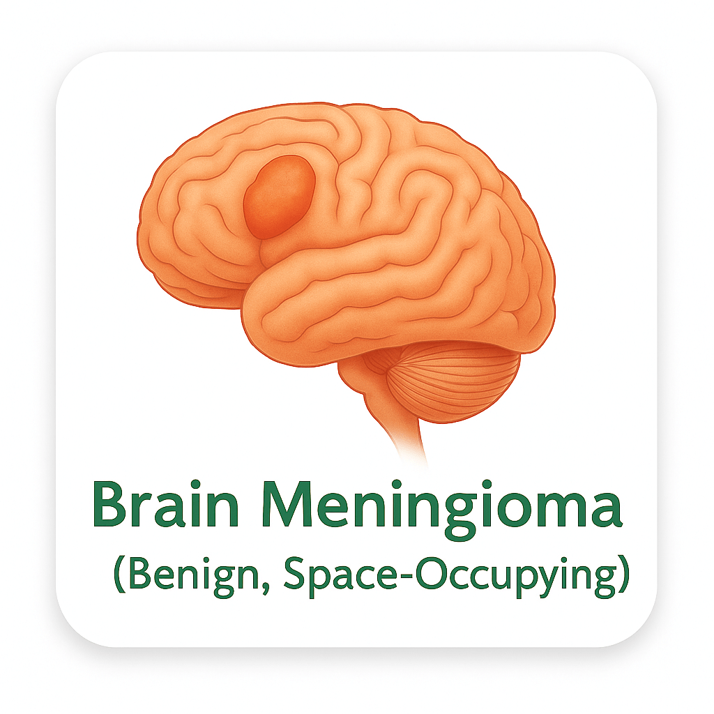 Brain Meningioma (Benign, Space-Occupying)