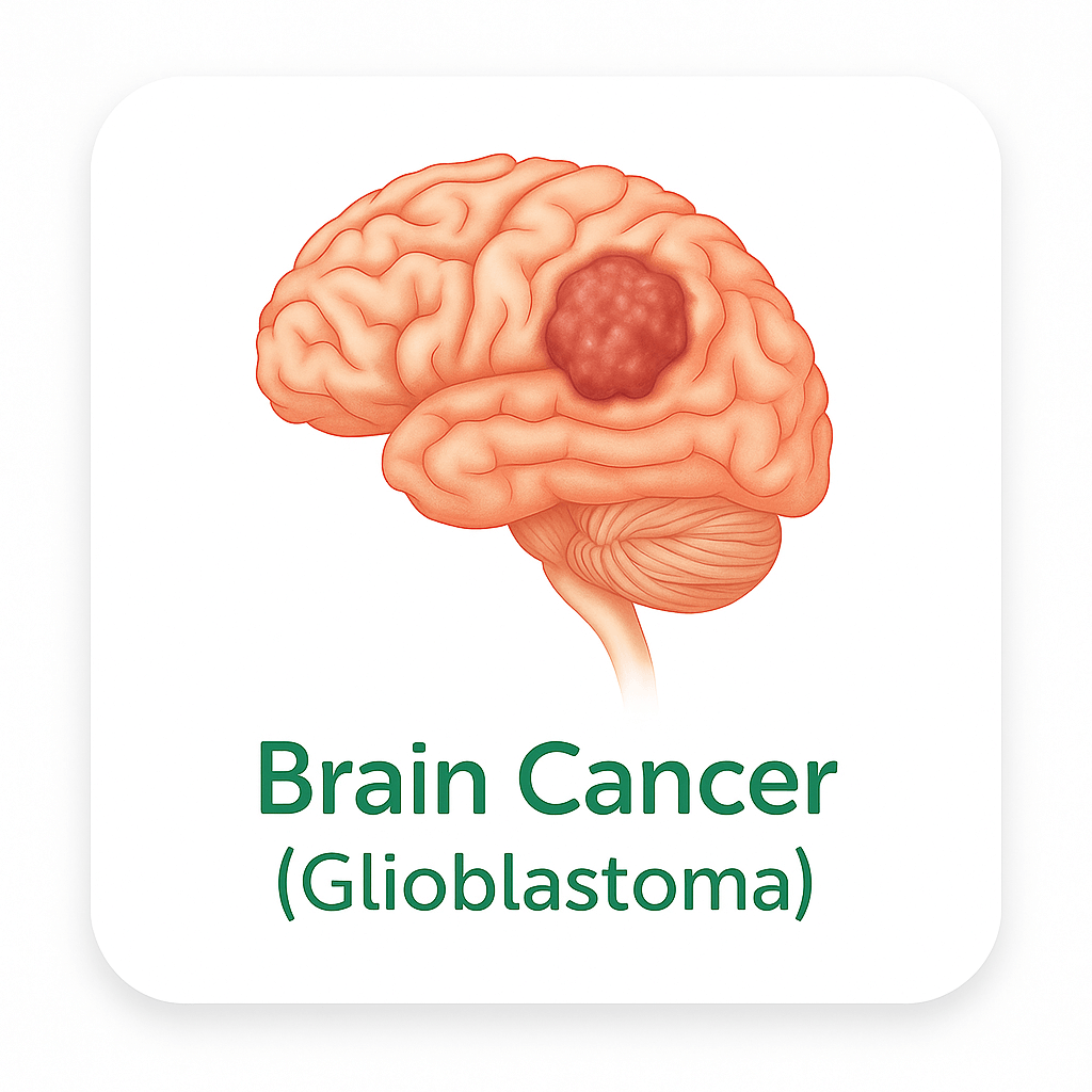 Brain Cancer (Glioblastoma)