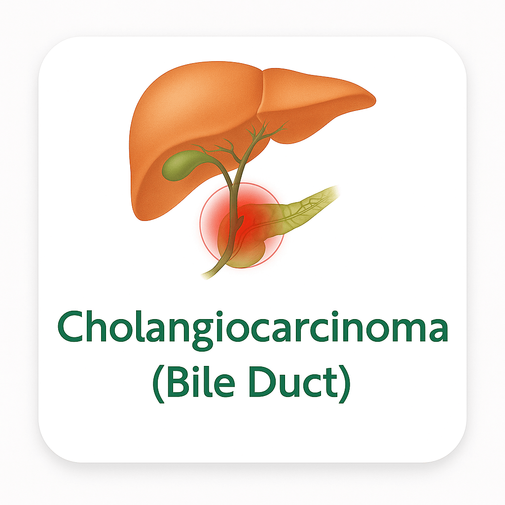 Cholangiocarcinoma (Bile Duct)