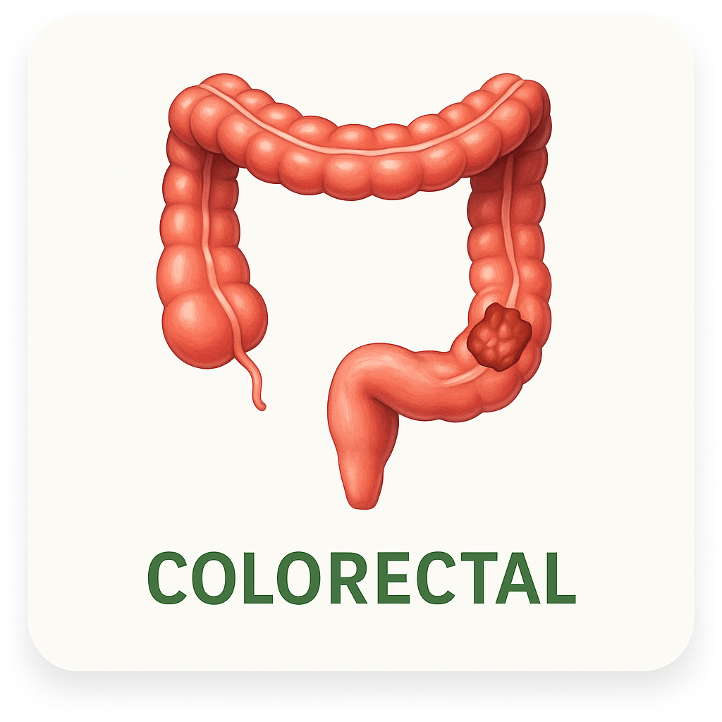 Colorectal Cancer