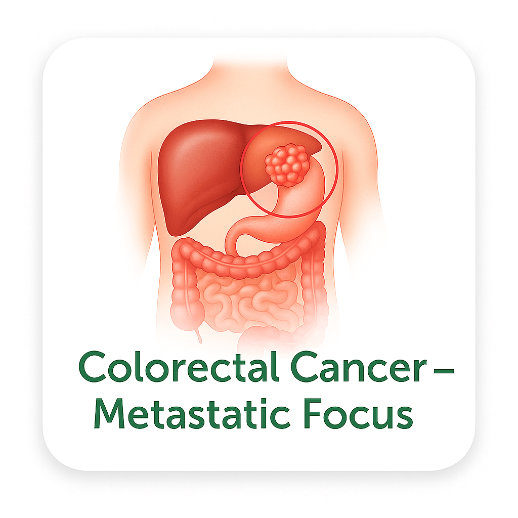 Colorectal Cancer – Metastatic Focus