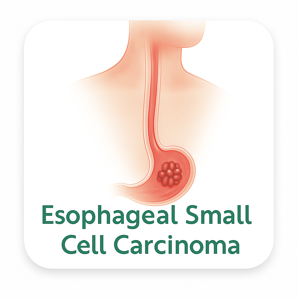 Esophageal Small Cell Carcinoma