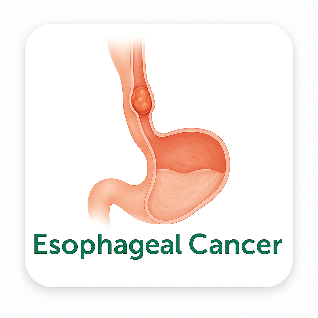 Esophageal Cancer