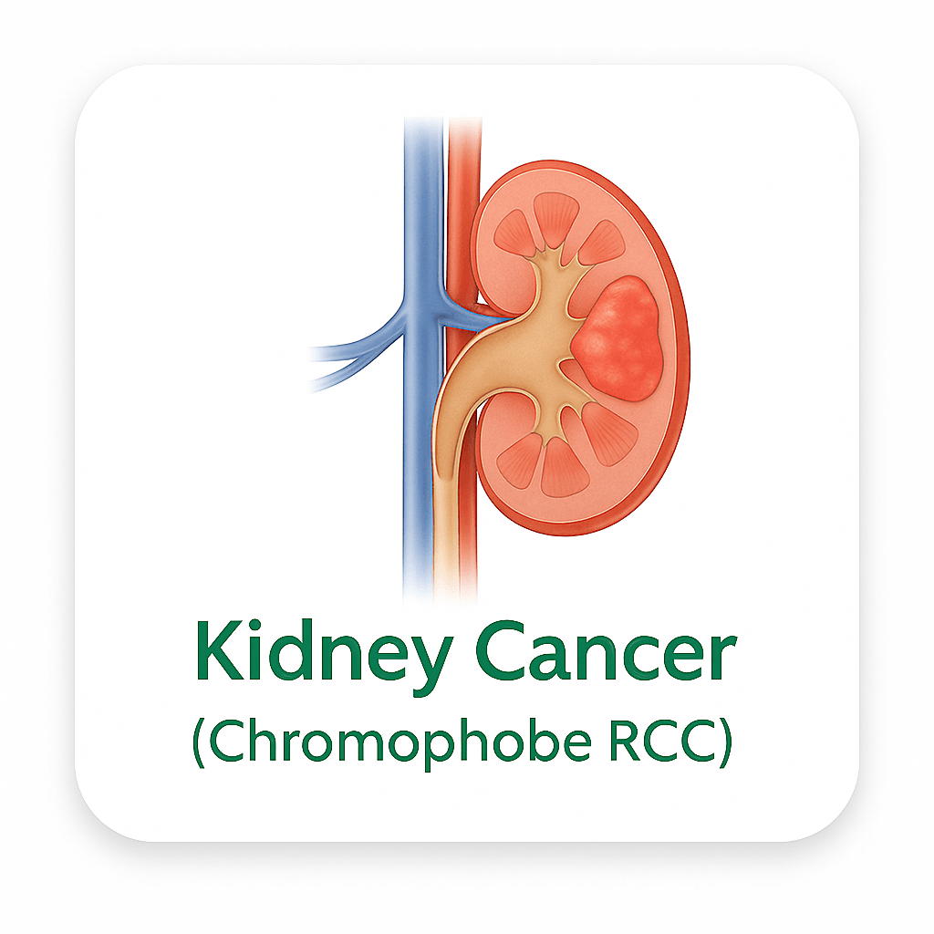 Kidney Cancer (Chromophobe RCC)