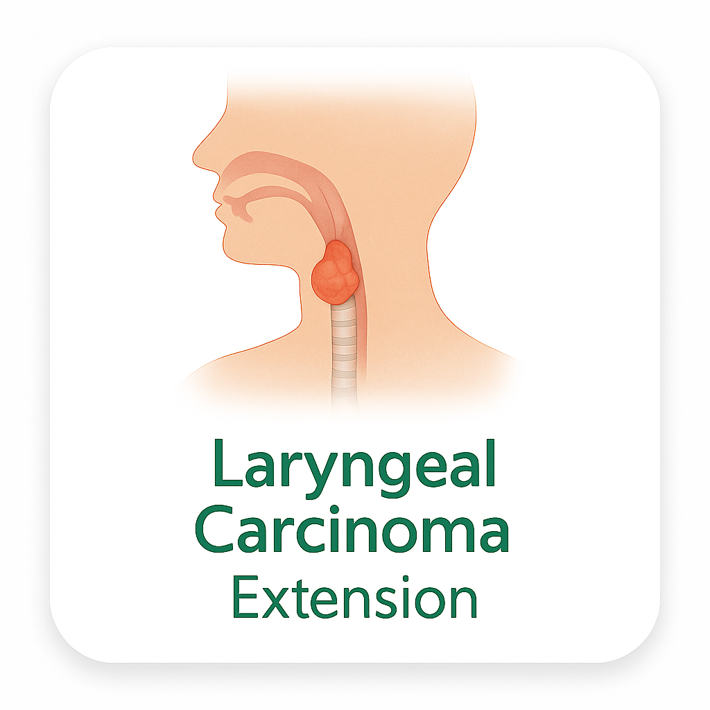 Laryngeal Carcinoma – Extension