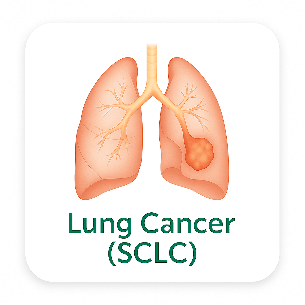 Lung Cancer (SCLC)