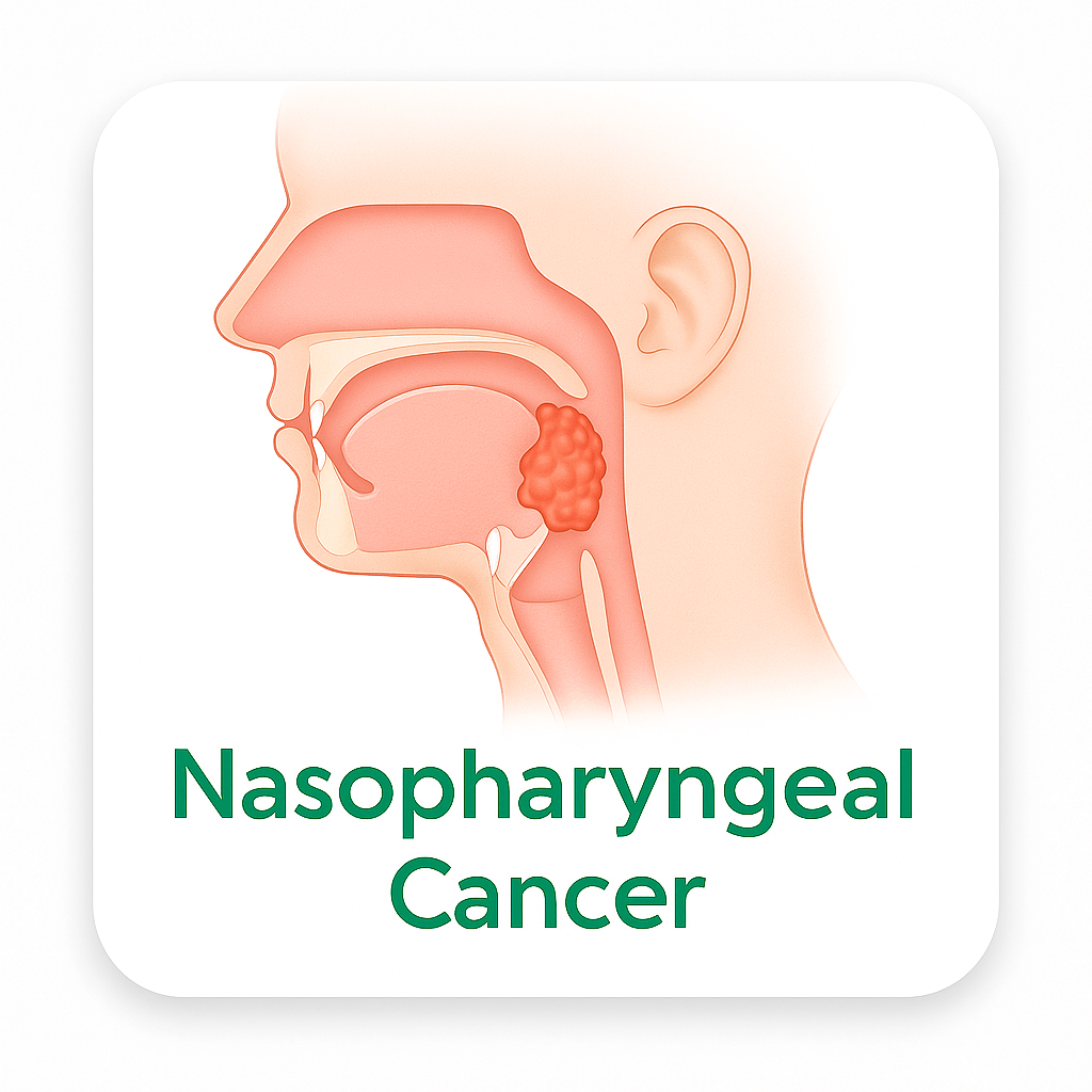 Nasopharyngeal Cancer
