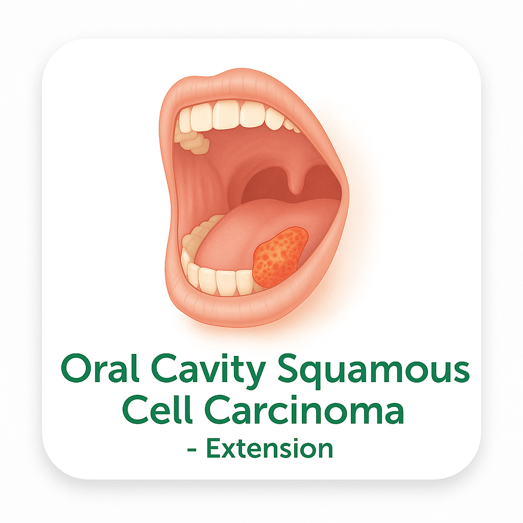 Oral Cavity Squamous Cell Carcinoma – Extension