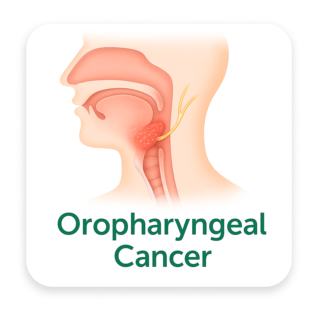 Oropharyngeal Cancer