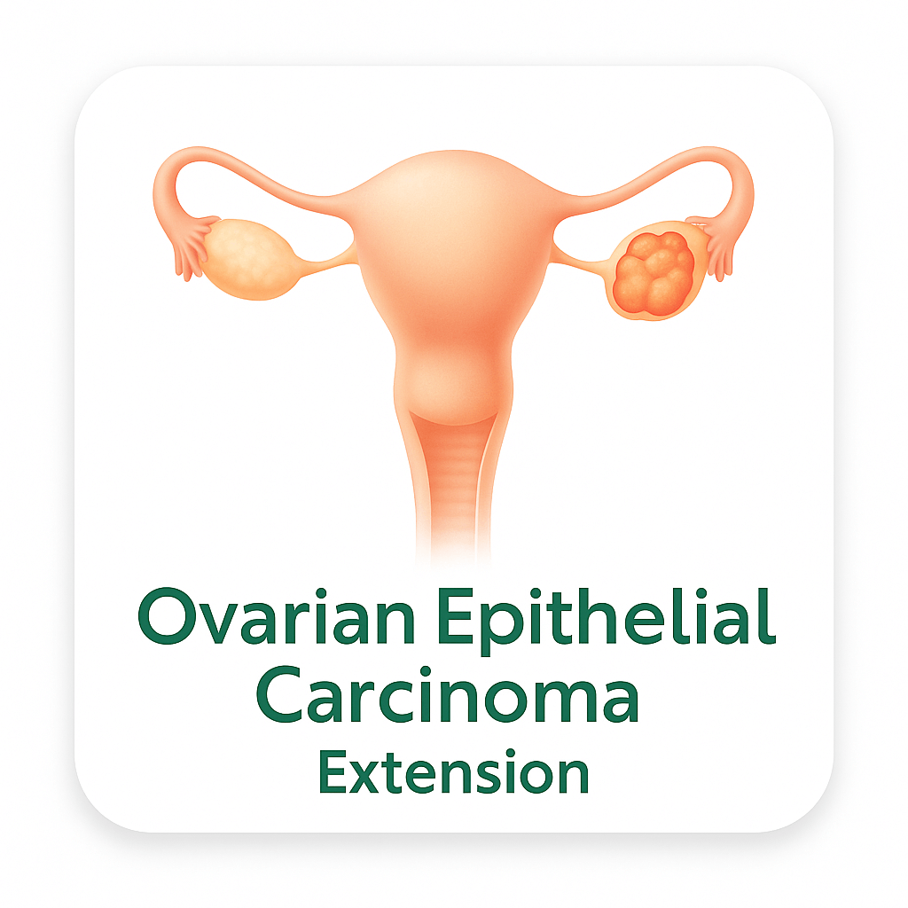 Ovarian Epithelial Carcinoma – Extension