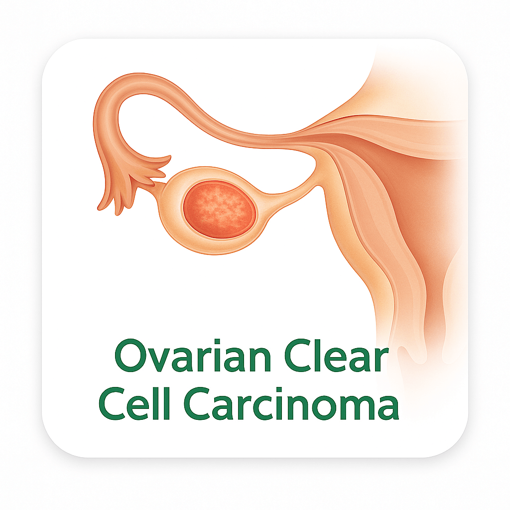 Ovarian Clear Cell Carcinoma – Extension
