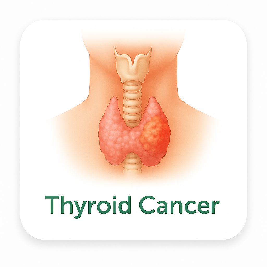 Thyroid Cancer