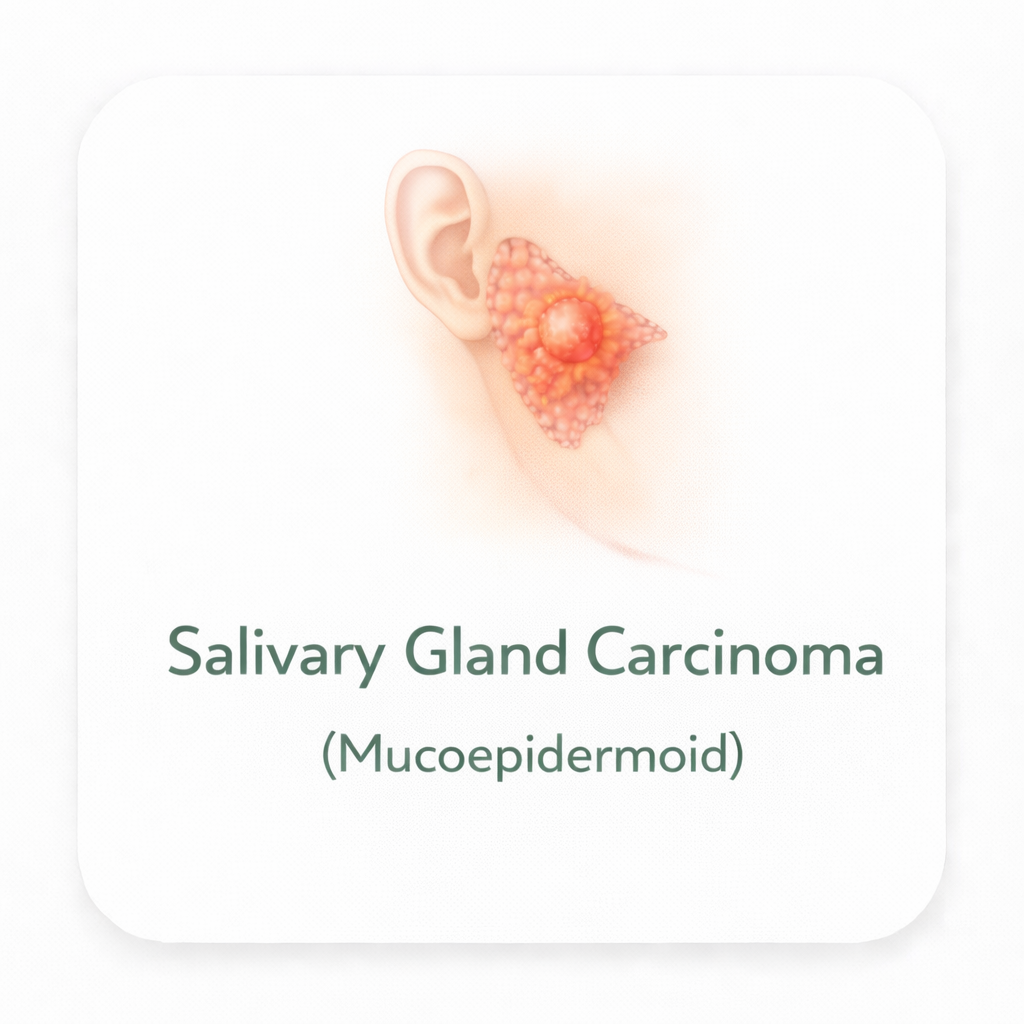 Salivary Gland Carcinoma (Mucoepidermoid)