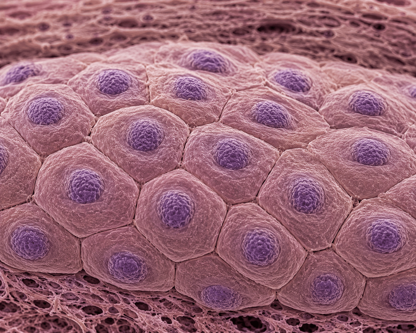 Mammary Epithelial Cell