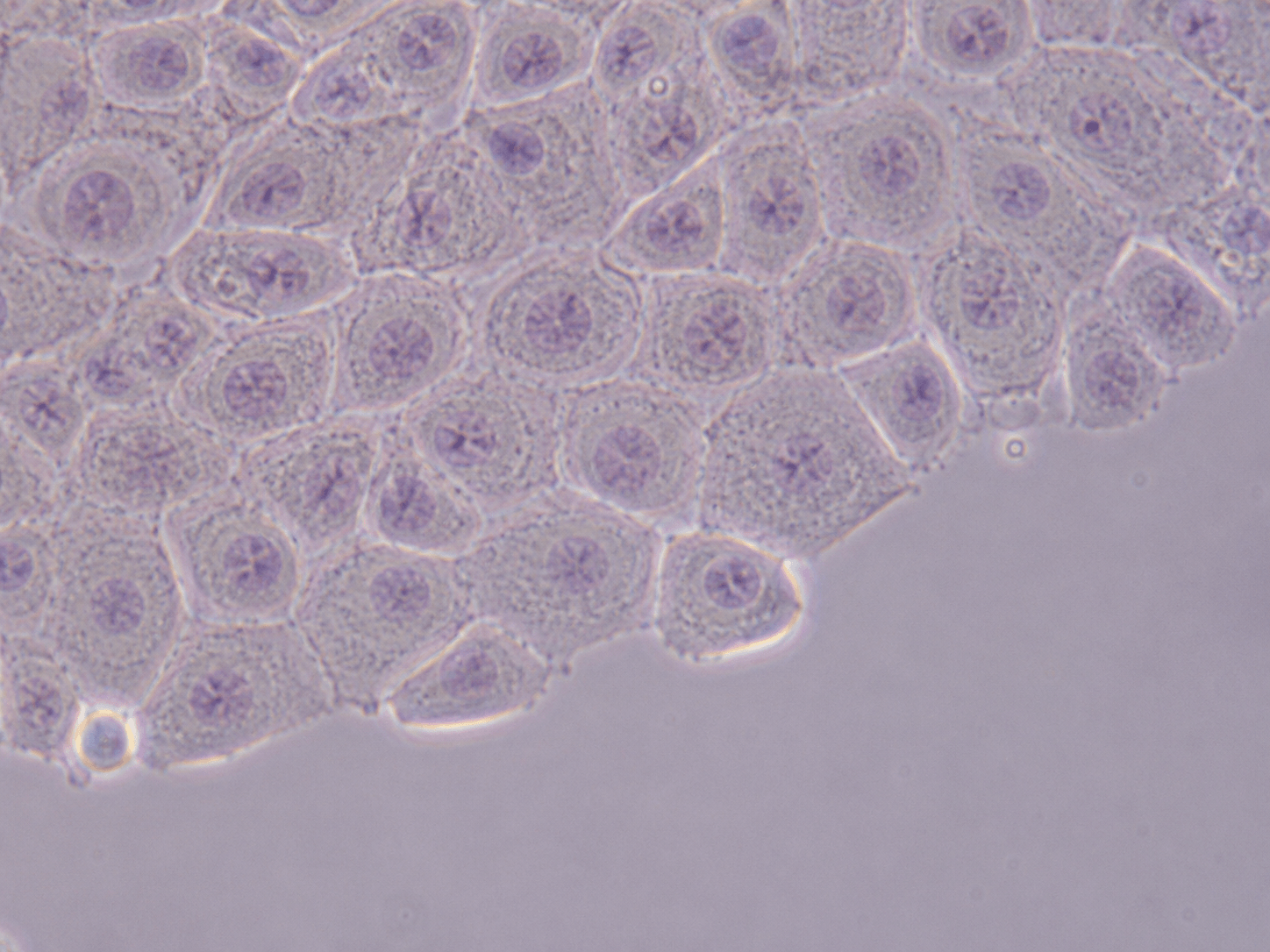 Ovarian Surface Epithelial Cell