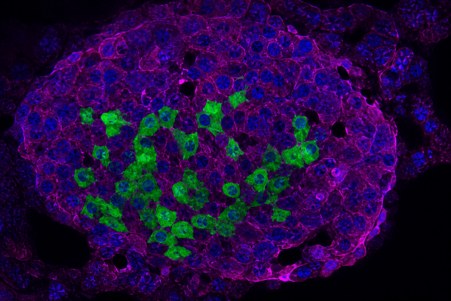 Pancreatic Alpha Cell