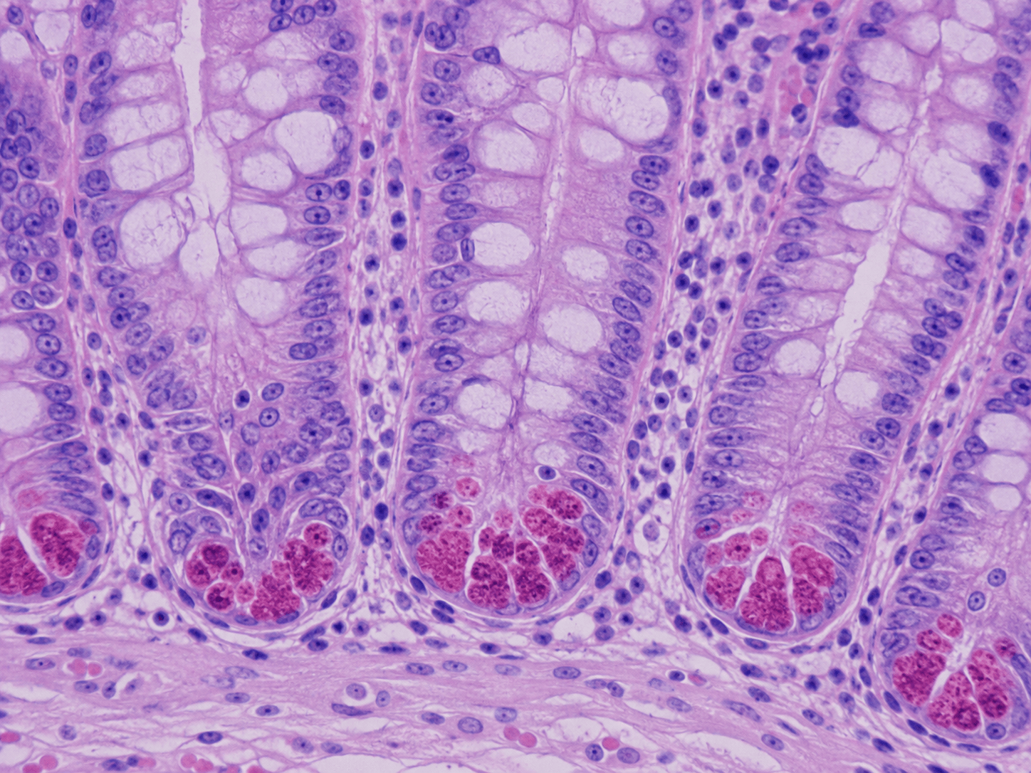 Paneth Cell