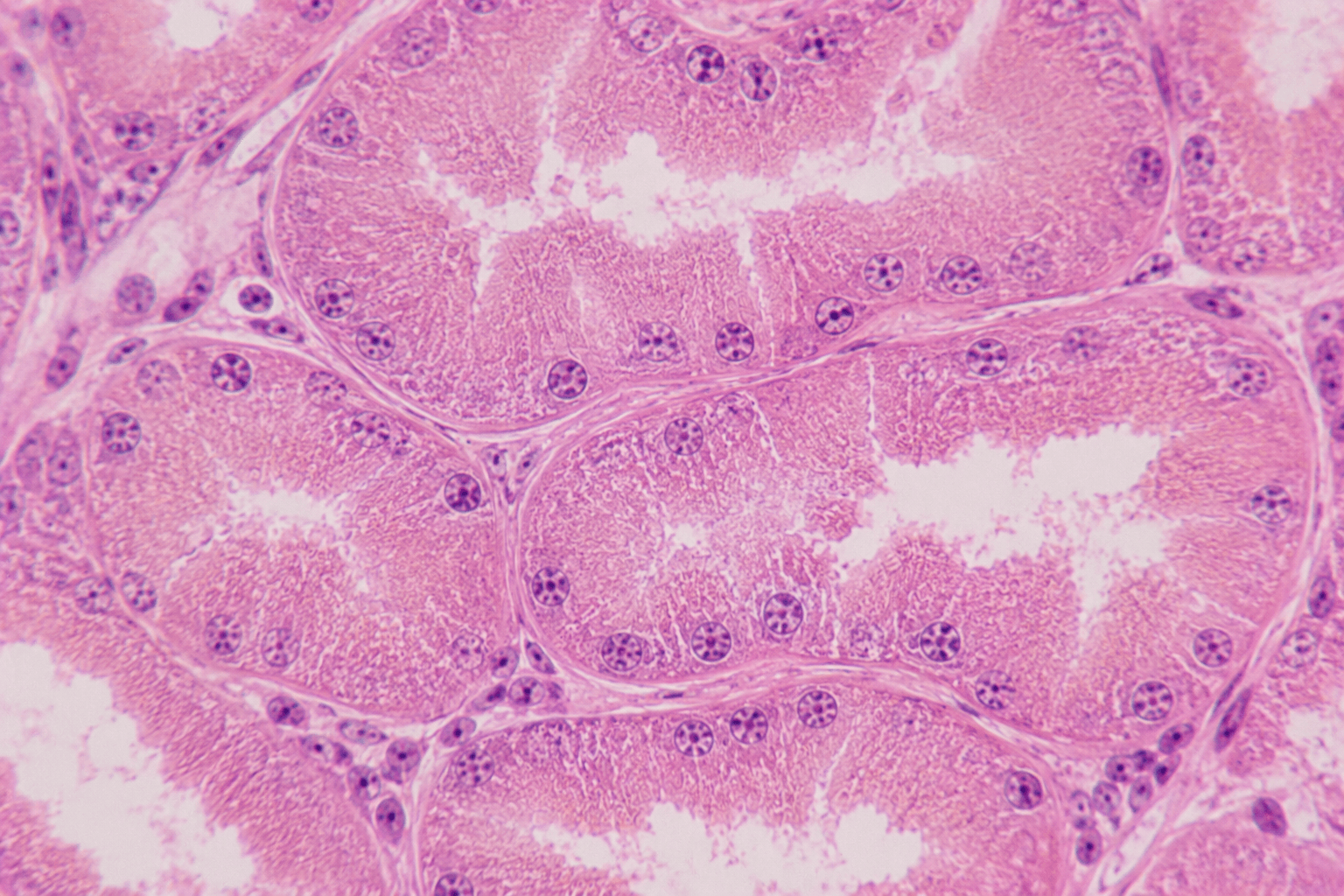 Proximal Tubule Cell