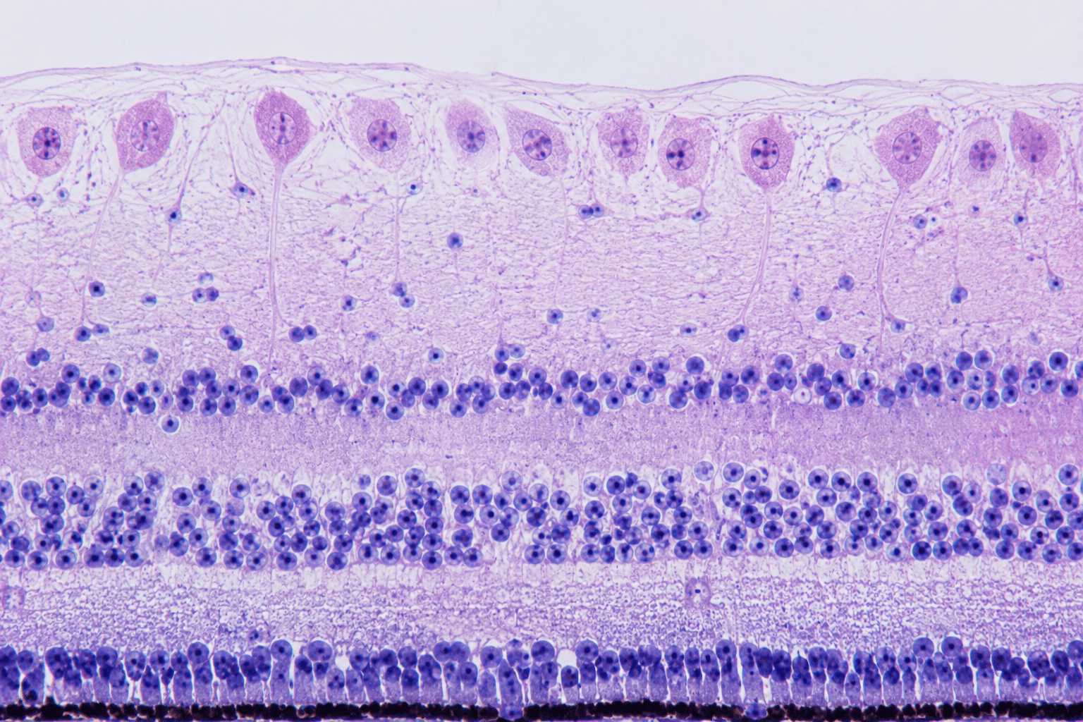 Retinal Ganglion Cell