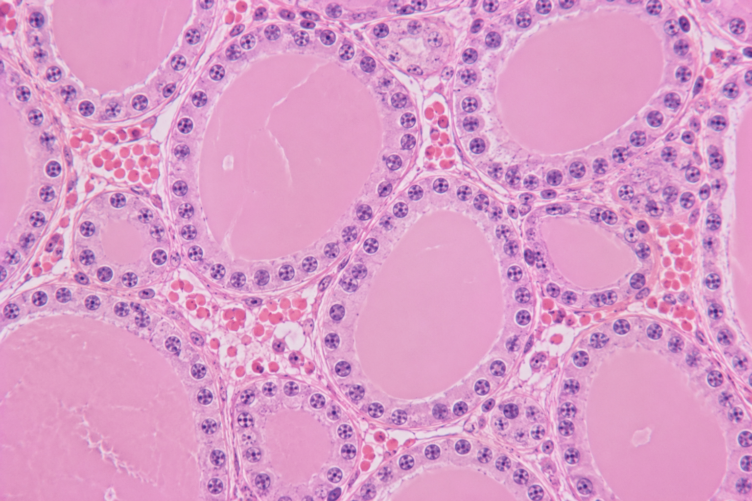 Thyroid Follicular Cell