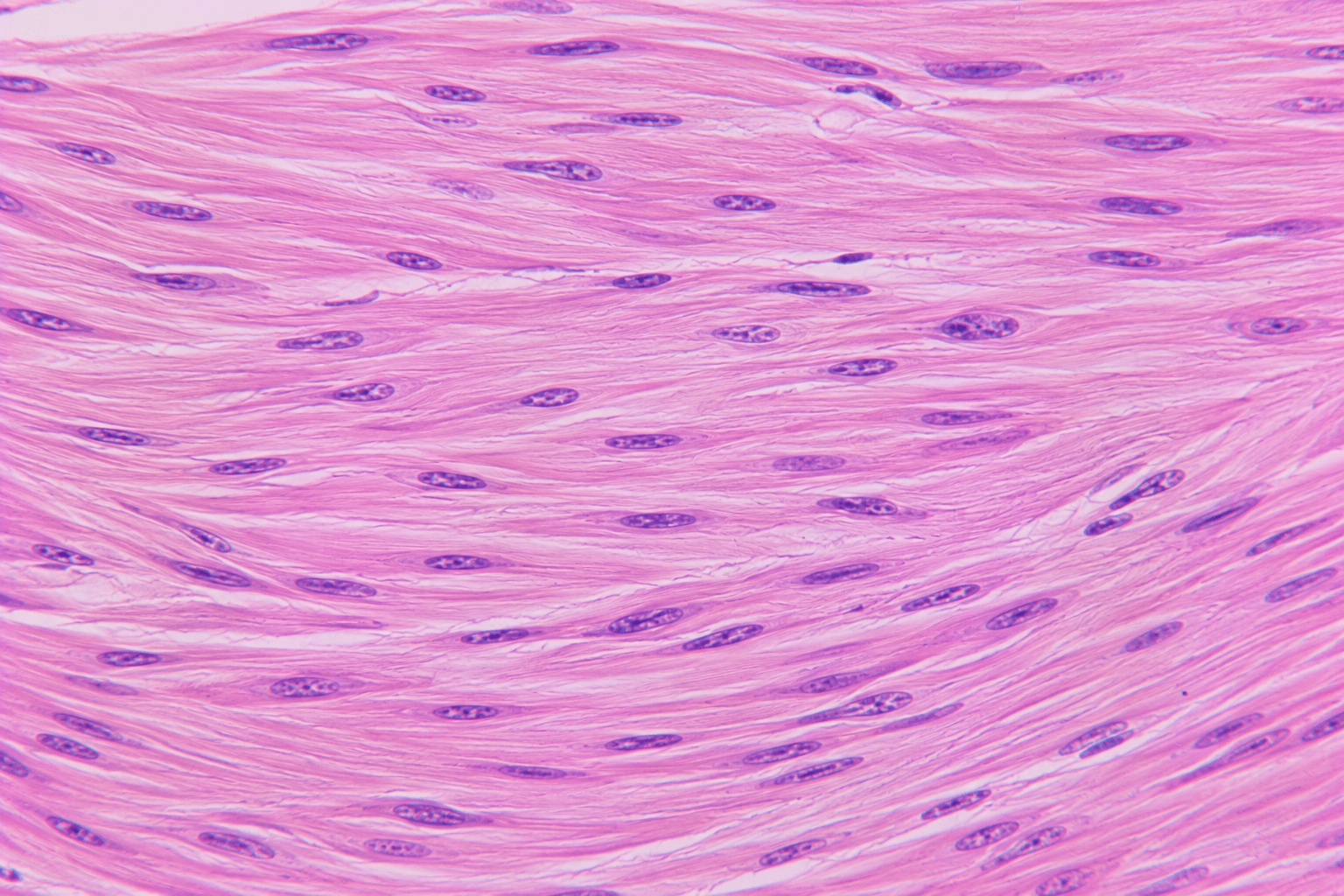 Vascular Smooth Muscle Cell