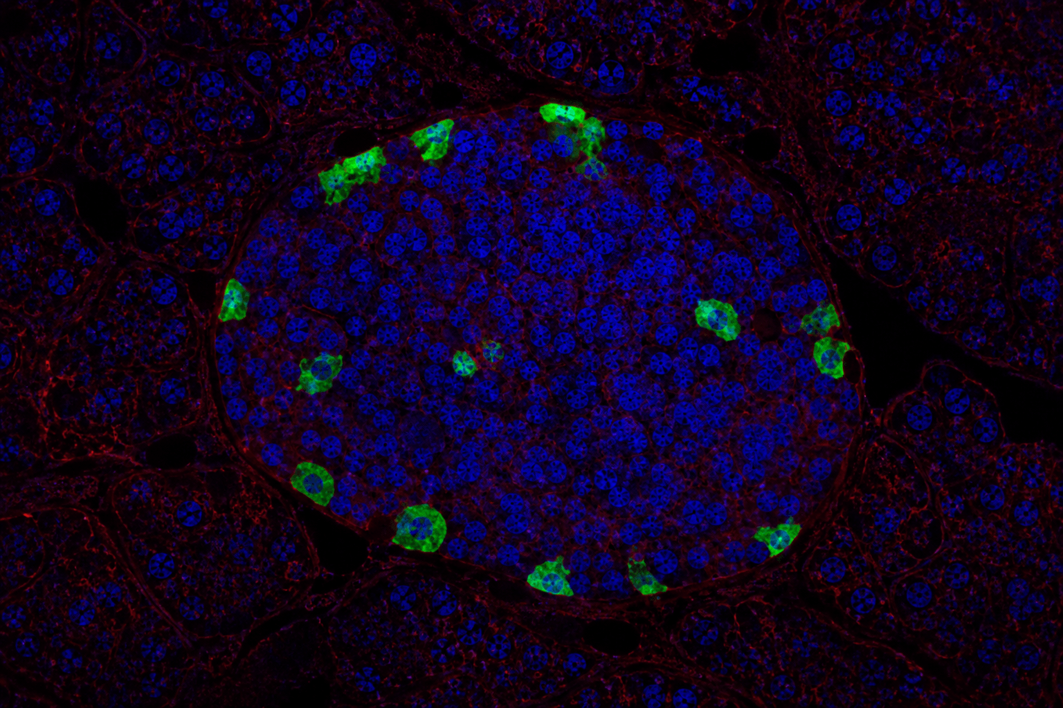 Pancreatic Delta Cell